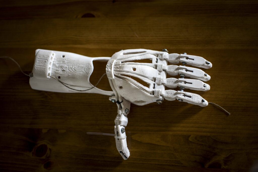 3D printed hand for a prosthetic limb